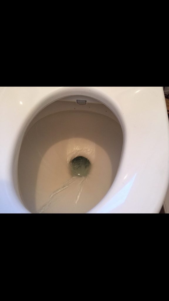 東京都葛飾区のトイレつまり修理業者を料金と事例で選ぶ